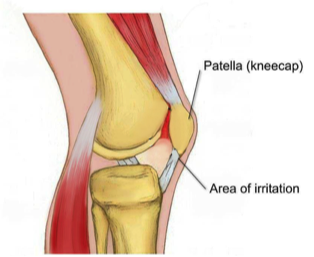 Some Surprising Facts About Posture